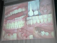 DENTRY DentalKongress Ruhr 2017